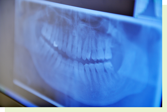 periodontal_image01